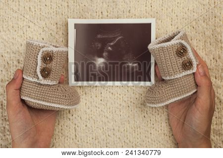 Ultrasound Photo And Baby Shoes In Woman Hands On Soft Knitted Background