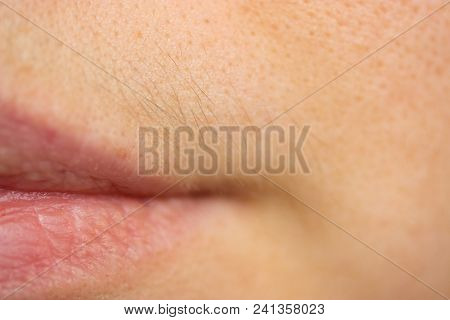 Small Hairs Above Lips