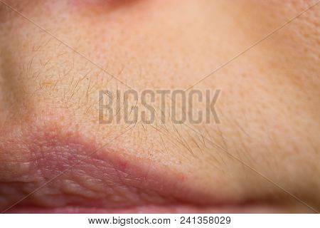Small Hairs Above Lips