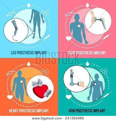 Prothesis Medical Implants Concept Flat Icons Square Set With Orthopedic Leg And Joints Replacement 