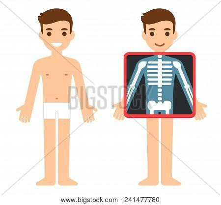 Cartoon Male Character Getting X-ray Checkup. Transparent Screen Showing Chest Bones. Radiography Ex