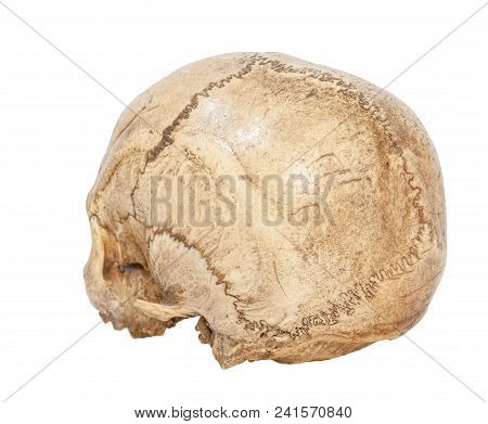 One Old Jawless Human Scull Isolated On White