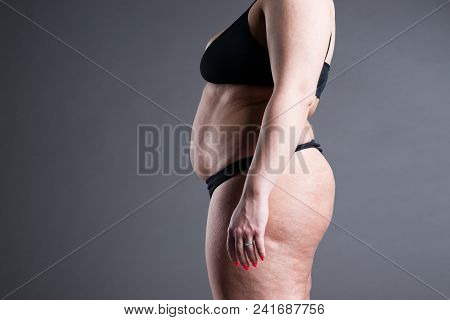 Overweight Woman With Fat Belly, Obesity Female Body On Gray Background