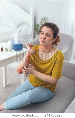 Itchy Spots. Young Girl Staying At Home Looking Desperate About Having A Rash Feeling An Irresistabl