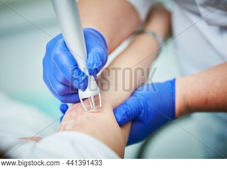 Laser cosmetic surgery and skin resurfacing in dermatology
