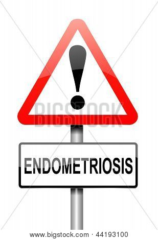 Endometriosis แนวคิด