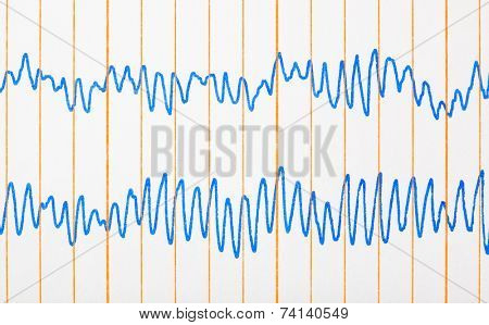 Electro cardiogram ecg - medical background