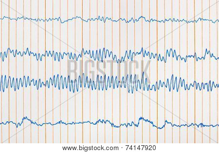 Electro cardiogram ecg - medical background