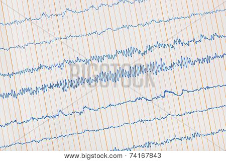Electro cardiogram ecg - medical background