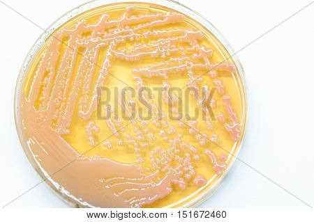 Bacterial Culture Growth On Macconkey Agar (gram Negative Bacilli).
