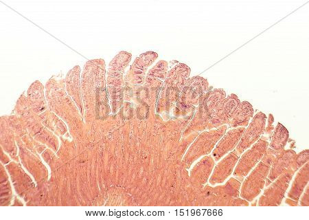 Villi of small intestine, light micrograph, magnification 40x