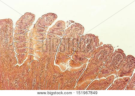 Villi of small intestine, light micrograph, magnification 100x