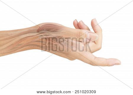 Wrist Muscle, Pain White Background Wrist Pain