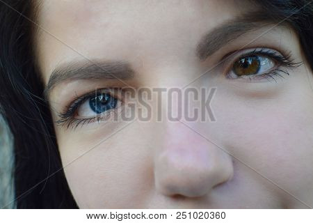 Beautiful Girl With Dark Hair And Different Eye Color Heterochromia . Smiles At The Photos In The Pa