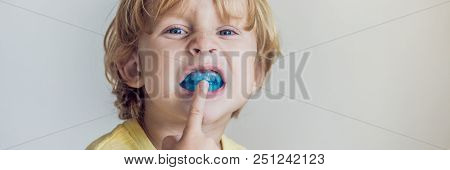 Three-year Old Boy Shows Myofunctional Trainer To Illuminate Mouth Breathing Habit. Helps Equalize T