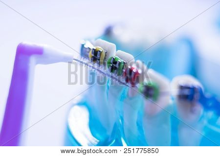 Interdental Teeth Brackets Clean