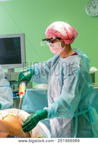 Cosmetic Liposuction Surgery In Actual Operating Room, Group Of Surgeons Working With Cannula