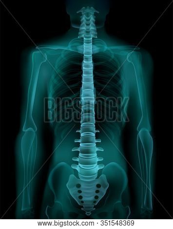 Human Spine And Pelvis Realistic X-ray Ct Radiography Fluoroscopy Medical Screening  Exam Image Vect