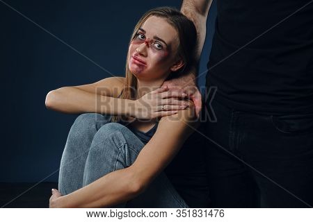 Strong Man Put His Hand On Female Shoulder. Scared Victim With Bruises On Face Sitting Nearby. Blue 