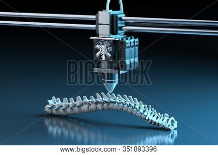 3D Printer Print Prosthetic Spine