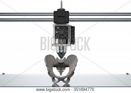 3D Printer Print Prosthetic Hip Bone