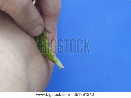 Removal Of Inflammation And Swelling Of The Skin On The Leg. A Man Rubs A Leaf Of Aloe Vera Inflamma