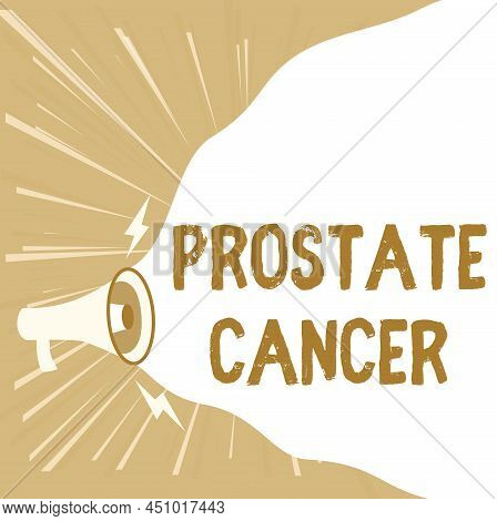 Handwriting Text Prostate Cancer. Conceptual Photo Cancer That Occurs In The Gland Of Male Reproduct