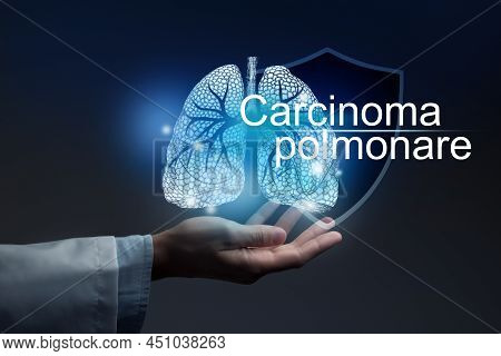 Medical Banner Carcinoma With Italian Translation Carcinoma Polmonare On Blue Background With Large 