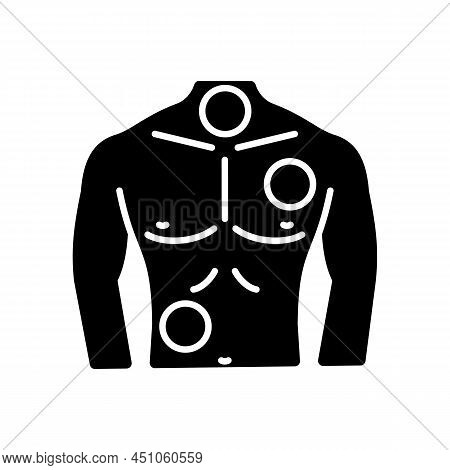 Metastases Black Glyph Icon. Chest Cancer. Thorax And Lungs Tumors. Spreading Of Cancer. Pathogenic 