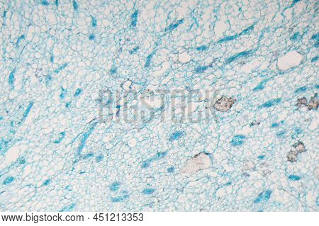 The Plant Pathogen Ustilago Maydis Under The Microscope