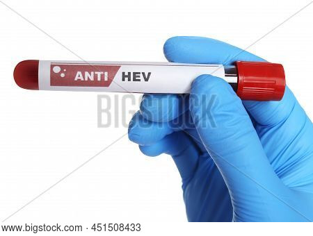Scientist Holding Tube With Blood Sample And Label Anti Hev On White Background, Closeup