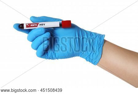 Scientist Holding Tube With Blood Sample And Label Anti Hev On White Background, Closeup
