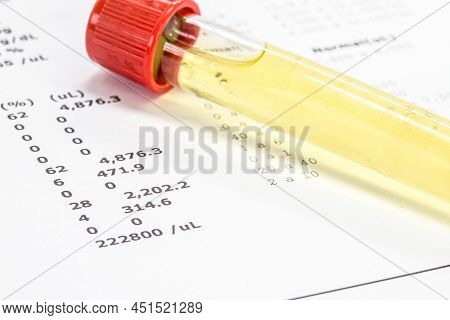 Urine Vial In Laboratory, Toxicology Or Routine Examination