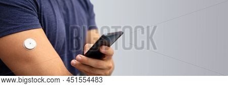 Man Testing Glucose Level With Continuous Glucose Monitor On Mobile Phone