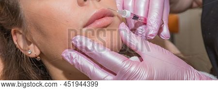 Russia, Moscow, 2 March 2022.young Woman Has A Botox Injections. Beauty Treatment With Hyaluronic Co