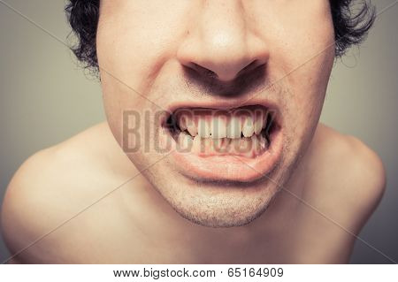 Young Man With Plaque On His Teeth