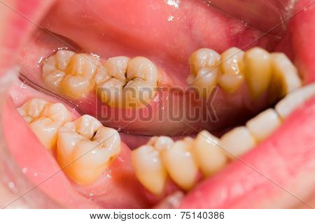 Simple Cavity
