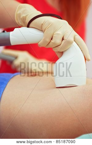 man receiving laser epilation at armpit on beauty center