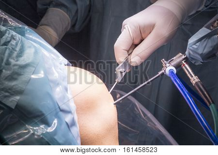 Surgical Operation Knee Surgery