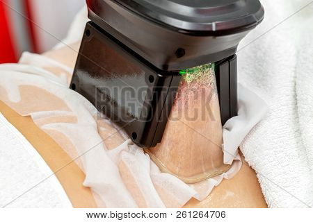 Woman Getting Cryolipolysis Fat Treatment Procedure In Professional Cosmetic Cabinet Or Spa Center