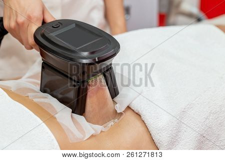 Woman Getting Cryolipolysis Fat Treatment Procedure In Professional Cosmetic Cabinet Or Spa Center