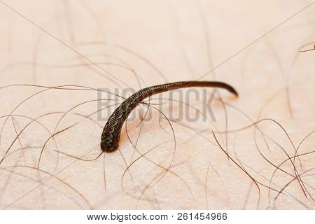 Tropical Land Leech/ Jawed Land Leech (haemadipsa Sp.) Sucking Some Blood From The Human Skin. (take