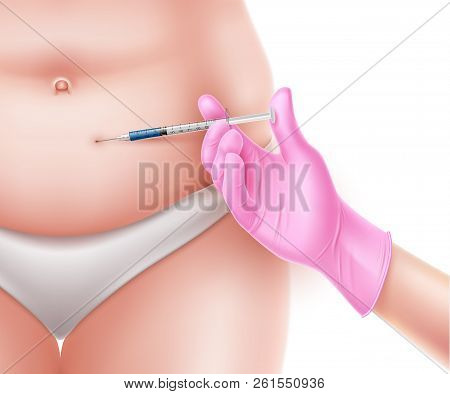 Vector Liposuction Surgery Doctor Hand And Syringe