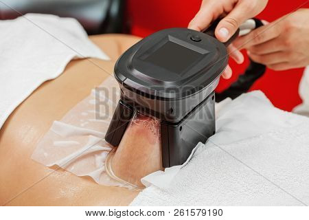 Woman Getting Cryolipolysis Fat Treatment Procedure In Professional Cosmetic Cabinet Or Spa Center