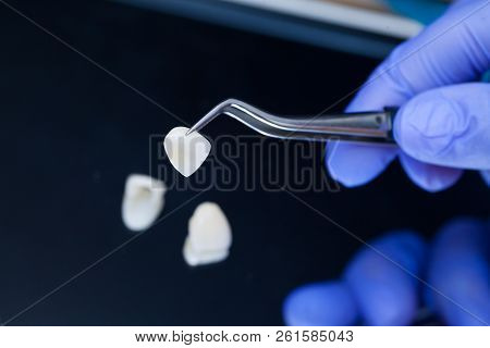 A Dentist Is Holding Tweezers For Dental Ceramic Veneers And Crowns. Closeup Hand In Blue Glove