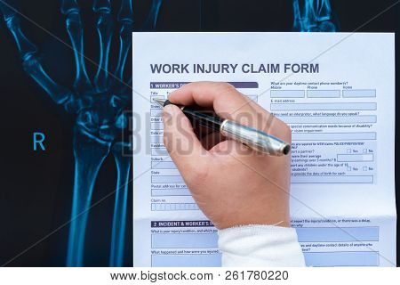 Filling Up A Work Injury Claim Form With A Wrapped Hand On Top Of An X-ray Film Medical And Insuranc