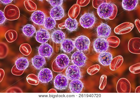 Destruction Of Lymphoblasts. Conceptual 3d Illustration Of Treatment Of Acute Lymphoblastic Leukemia