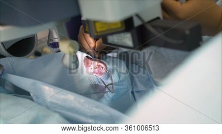 Eye Microsurgery. Eye Surgery. Vision Correction Surgery. Doctor Performing Laser Eye Vision Correct