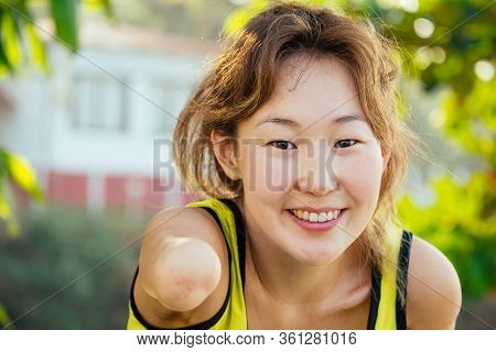 Happy Asian Armless Woman Warming Up Before Swimming At The Tropical Beach