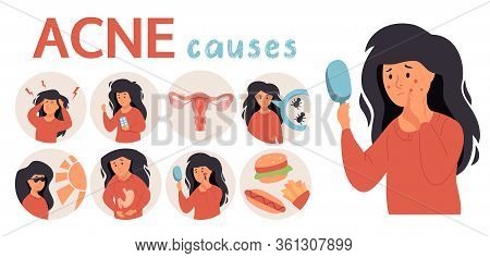 Acne Infographic. Unhappy Girl Struggling With Acne, Pimples. Skin Face Irritation Problem.